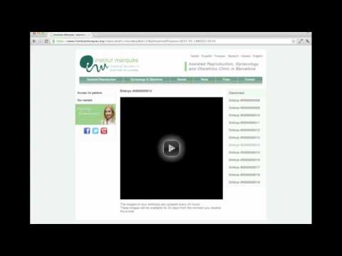 Embryoscope: watch your