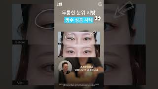 두툼한 눈 ☆필수시청☆ #shorts
