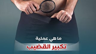 تكبير العضو الذكري - Penis enlargement