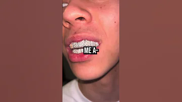 Ray Is Aura Farming With His New Grillz 