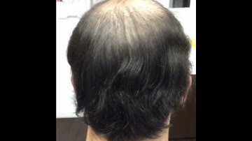 SMP Scalp Hair Tattoo Online Training Certificate Program