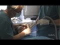 Cirugía maxilofacial con sedación consciente