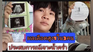 #แชร์ประสบการณ์เจาะน้ำคร่ำ#คัดกรองดาวน์ความเสี่ยงสูง#ติด1ใน3คนสูงคัก