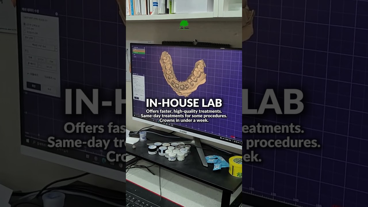 Why Everyone Flies to Oaks Dental Korea for Dental Care?