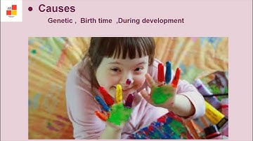 Chapter 8 SPECIAL EDUCATION AND SUPPORT SERVICES Class XII Home Science Lectures By Divya Gulati