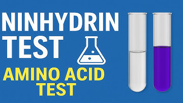 Ninhydrin Test for Amino Acids | Principle, Procedure, and Result