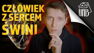 Człowiek z sercem świni!