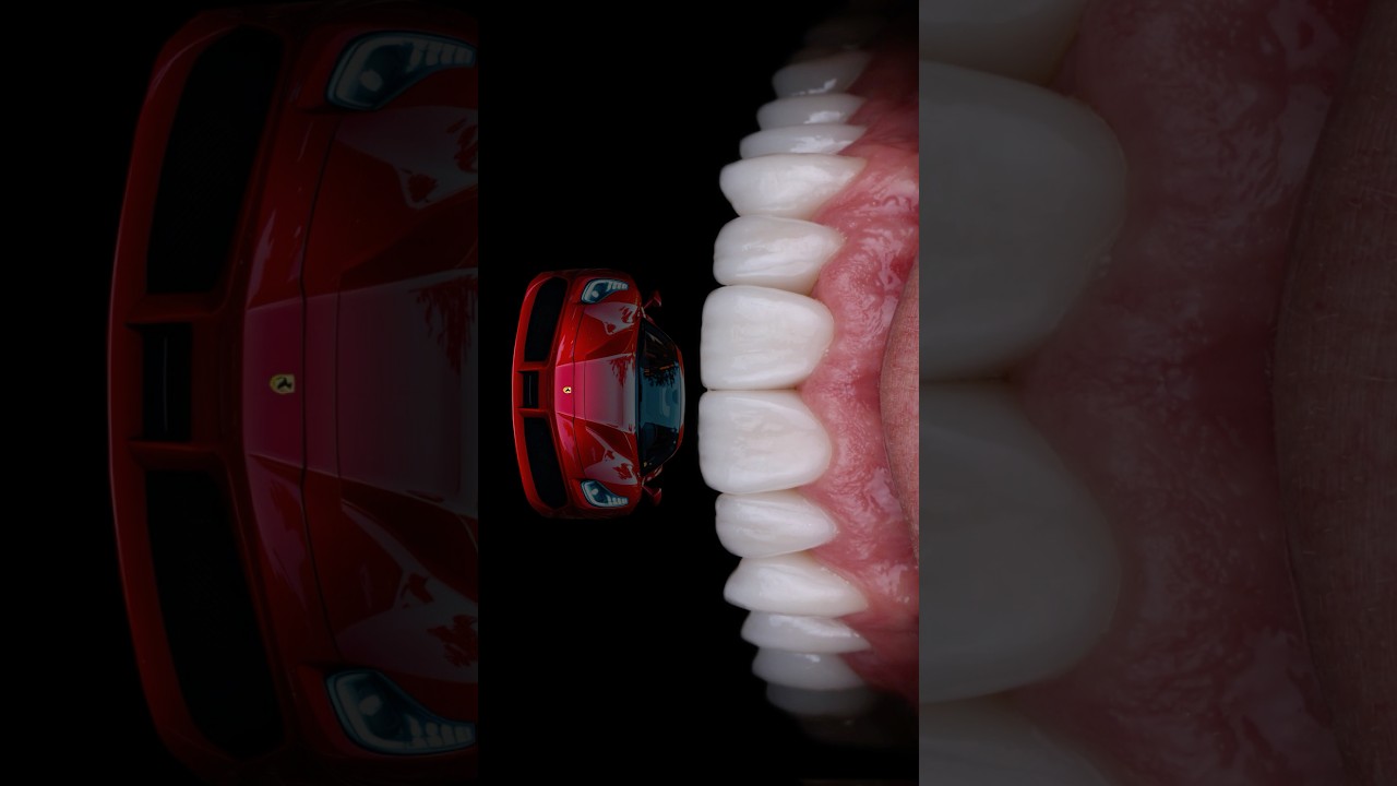 Dental Photography Motion Design #dentalphotography #dentist #dentalartistry #smiledesigndental