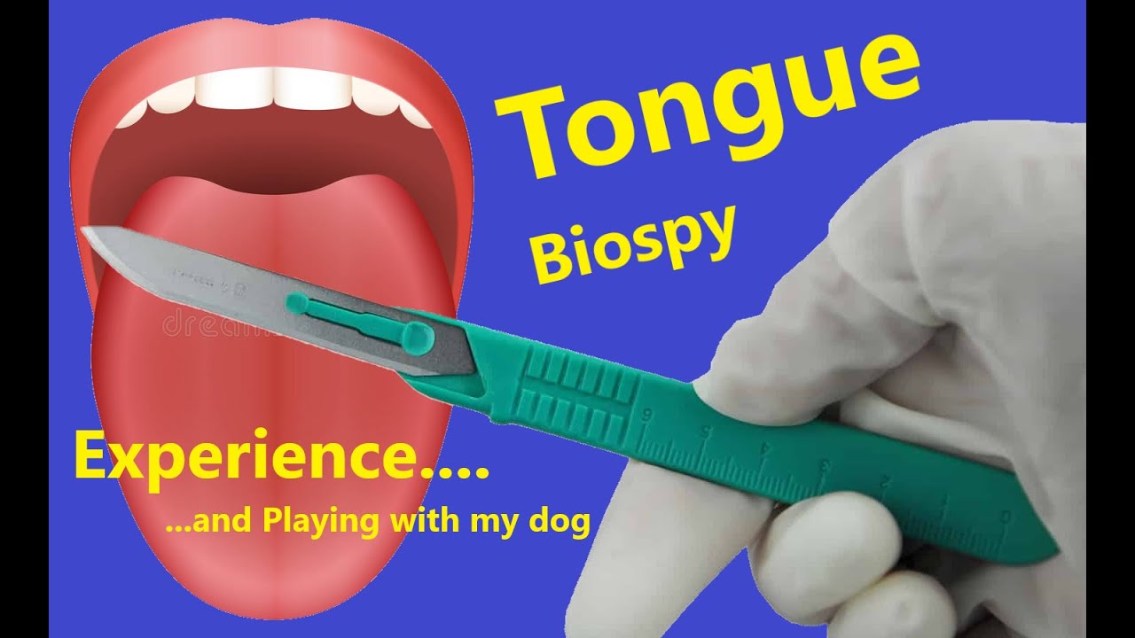 Tongue Biopsy Experience While I Play With My Dog YouTube Tongue Biopsy Experience While I Play With My Dog YouTube