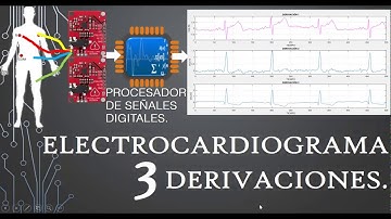 Electrocardiograma usando dos sensores ad8232