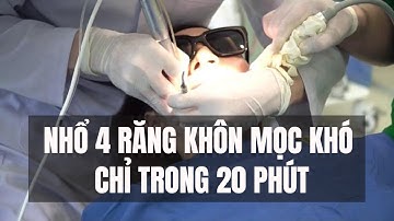 TRỰC TIẾP: XEM NHANH KHẺO LỠ CA NHỔ RĂNG KHÔN MỌC "KHÓ" | 20 PHÚT NHỔ 4 RĂNG KHÔN