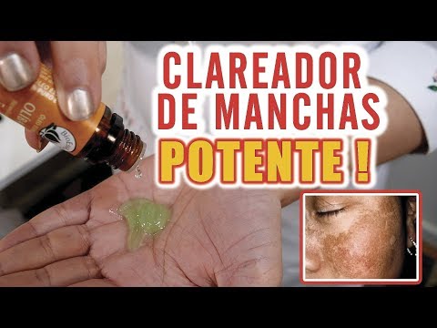 Vídeo: O Melhor Produto Para Manchas