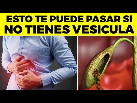 Video: ¿Cuántas calorías cuando te entuban?