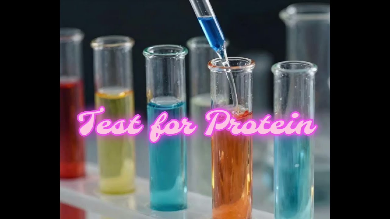 Urine test #Protein *11