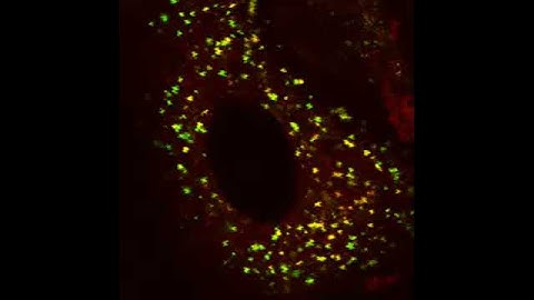 Lysotracker Green Nanoparticles Timelapse.avi
