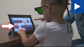 End of the eye patch for kids as new tech is tested | Latest News screenshot 3