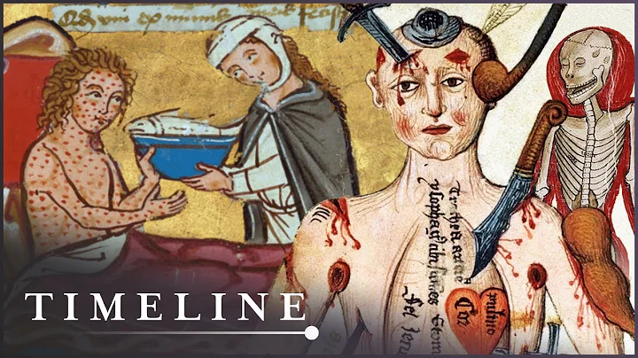 The Most Gruesome Diseases Of The Middle Ages | Medieval Dead | Timeline - DayDayNews