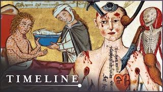 The Most Gruesome Diseases Of The Middle Ages | Medieval Dead | Timeline screenshot 5