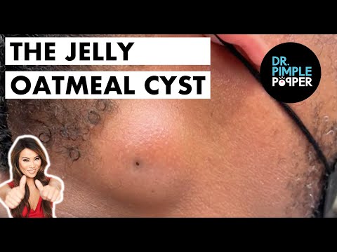 Video: Oatmeal Jelly