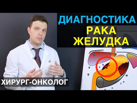 Диагностика рака желудка. Все виды диагностики рака желудка