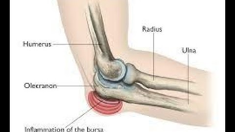 Excision of Bursa CPT code - simplify medical coding