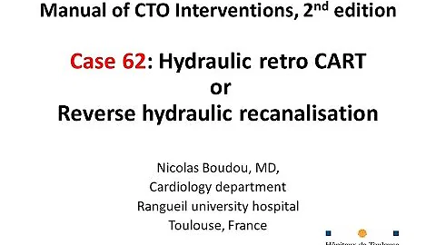 Case 62: Manual of CTO Interventions - Retrograde Carlino