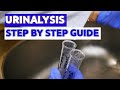 How to do urinalysis medical laboratory science