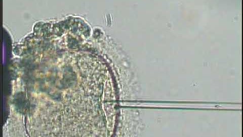 ICSI - INJECTION OF HUMAN OOCYTES 4 - DR.T.S.SHANMUGAPRIYA