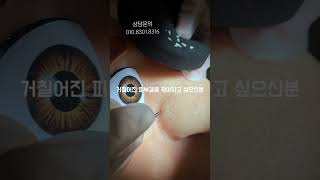 학씨..아저씨도 고민인 과다피지 걱정마세요#솔루션#올인원솔루션#과다피지#윤쌤뷰티#여드름학씨세트