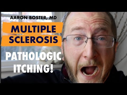 मल्टीपल स्केलेरोसिस दुर्लभ लक्षण: एमएस के साथ पैथोलॉजिकल खुजली