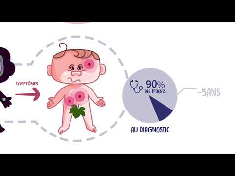 Vidéo: Neuroblastome