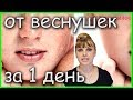 НАУЧИСЬ быстро и эффективно УБИРАТЬ ВЕСНУШКИ и ПИГМЕНТНЫЕ ПЯТНА!!!