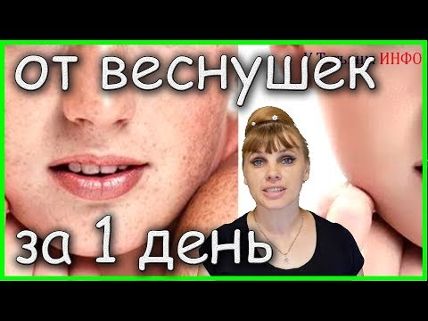 Как избавиться от веснушек в домашних условиях за 1 день