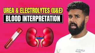 Famous Urea & Electrolytes (U&E) Blood Interpretation | Pareto Education Net Worth