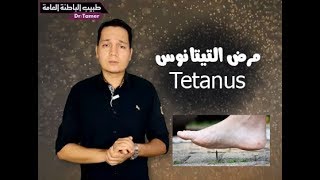 التيتانوس / Tetanus