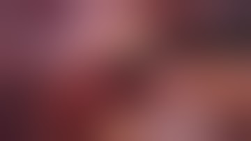 Video of autonomic nerve preserving in laparoscopic total mesorectal excision