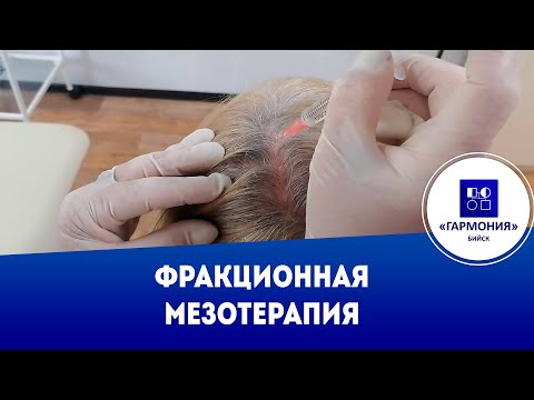 Фракционная мезотерапия