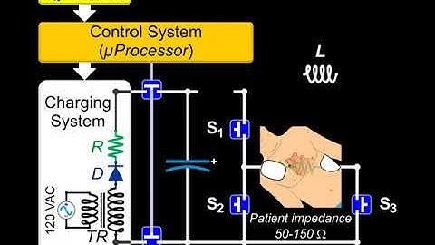 Monophasic Defibrillator - Block  Diagram