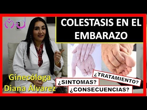 COLESTASIS EN EL EMBARAZO, POR GINECOLOGA DIANA ALVAREZ