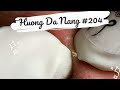 #204 | Huong Da Nang