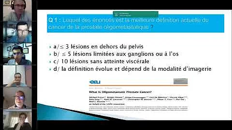 Le cancer oligomtastatique de la prostate.