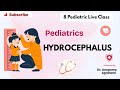 Hydrocephalus 🧠👶