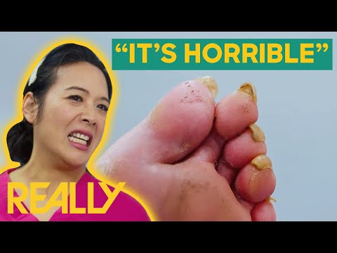 Marion Assists a Patient with Severely Odorous Feet | The Bad Foot Clinic | Brand New Series