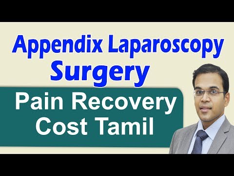 Appendix Laparoscopy Surgery Painfree Hospital Recovery Cost Best Laparoscopic Surgeon in Coimbator