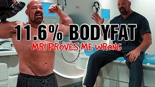 Brain Shaw 11 6 MRI Proves Me Wrong