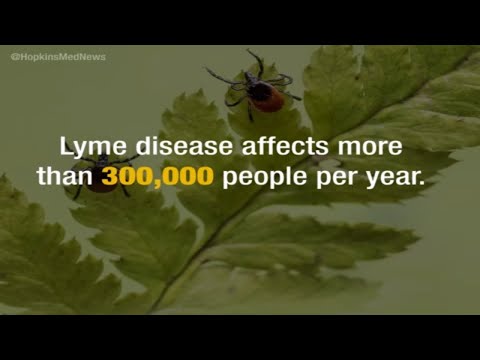 New Lyme Disease Scan Technique Reveals Brain Inflammation with Post-Treatment Lyme Disease Syndrome