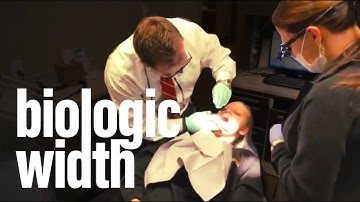 Biologic Width!!