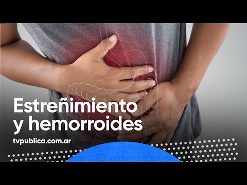 Video: ¿Pueden las hemorroides causar estreñimiento?