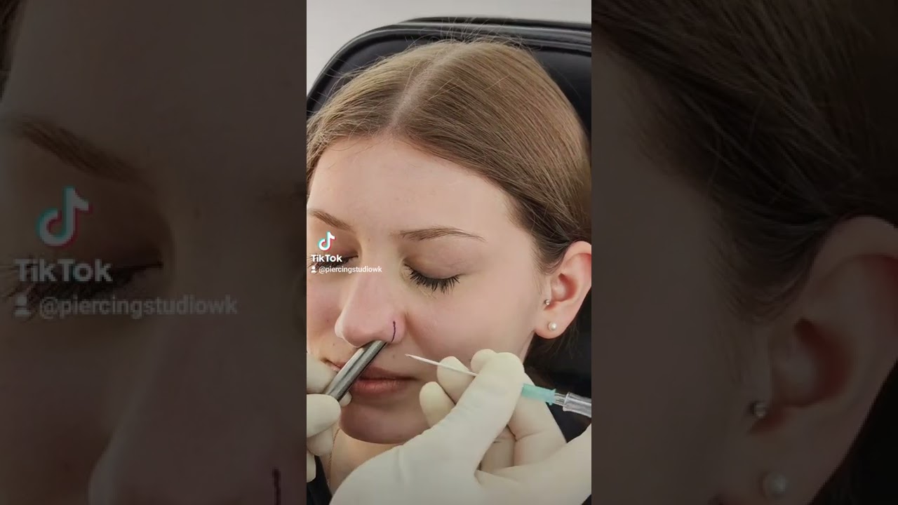 Wie Lange Braucht Ein Nasenpiercing Zum Verheilen Nostril (Nasenpiercing) 💉 optimiert für einen Ring nach Wundheilung #