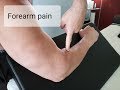 Radial Tunnel Syndrome: Forearm pain from screwdriver motion